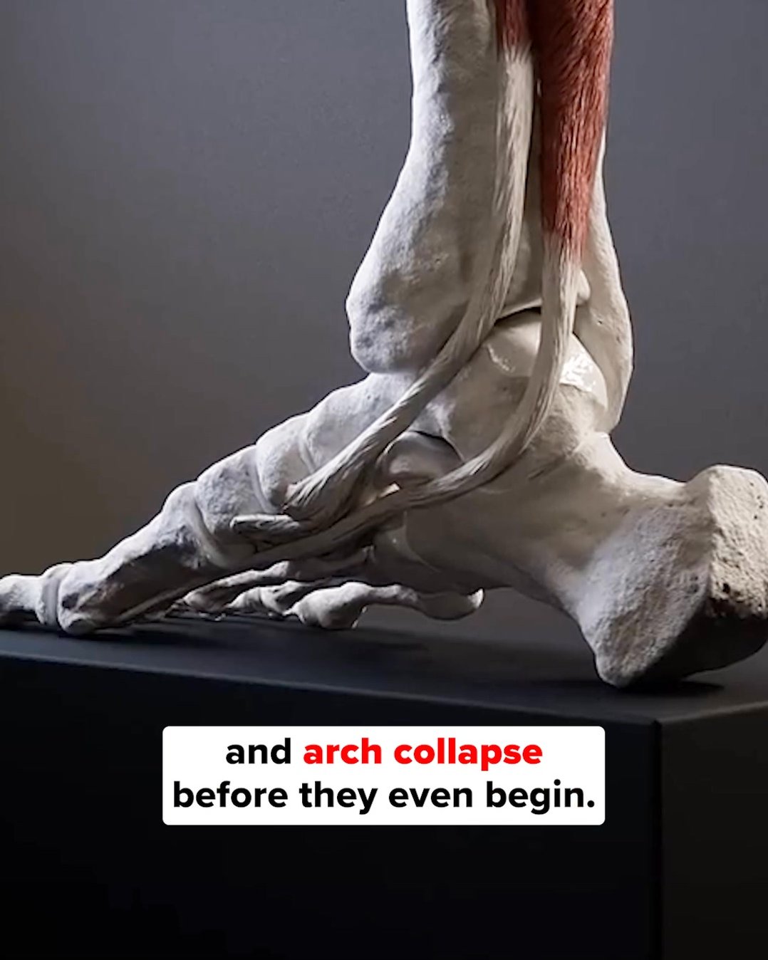 Experience Total-Body Comfort with Custom Moldable Insoles in Just 5 Minutes