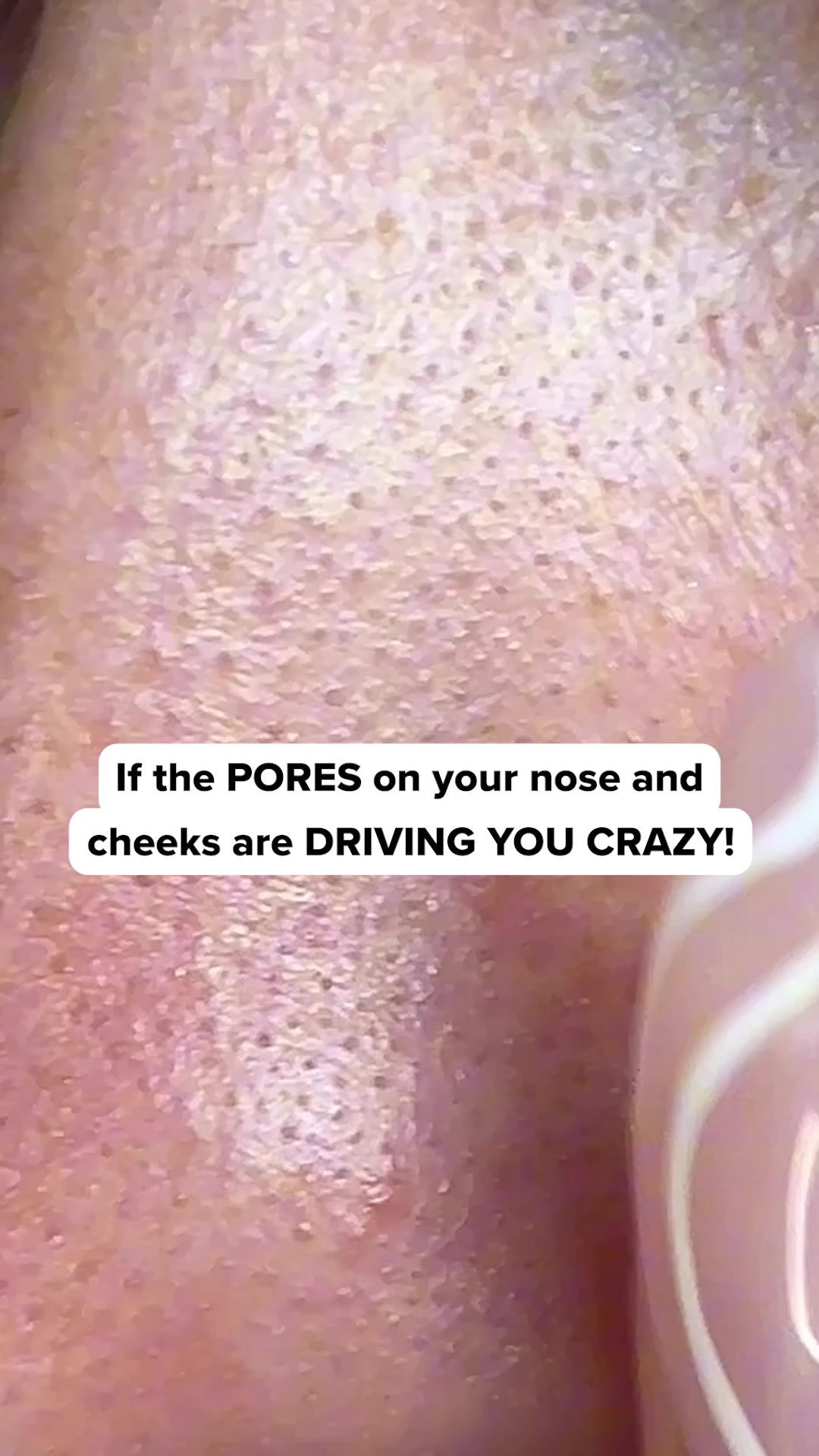 Smoother Skin In Just 10 Minutes