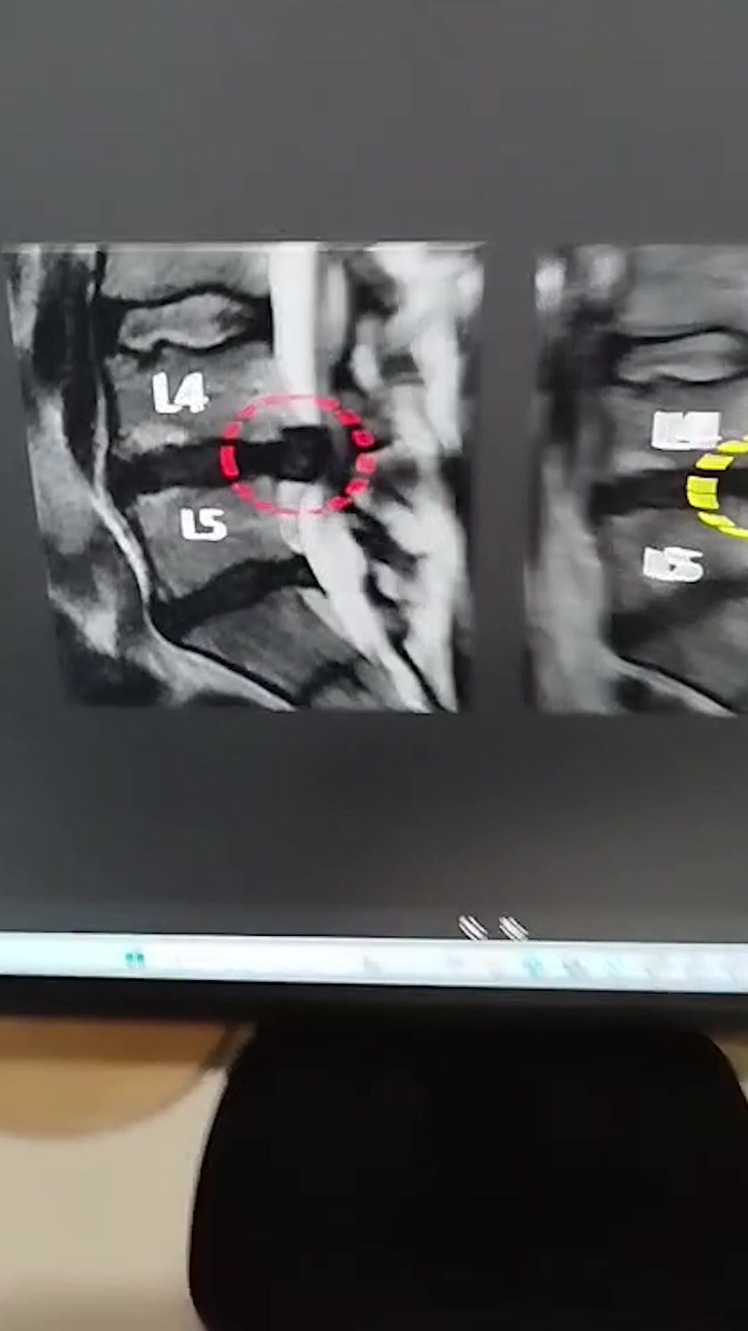 3 Ways To Get Back Pain Relief