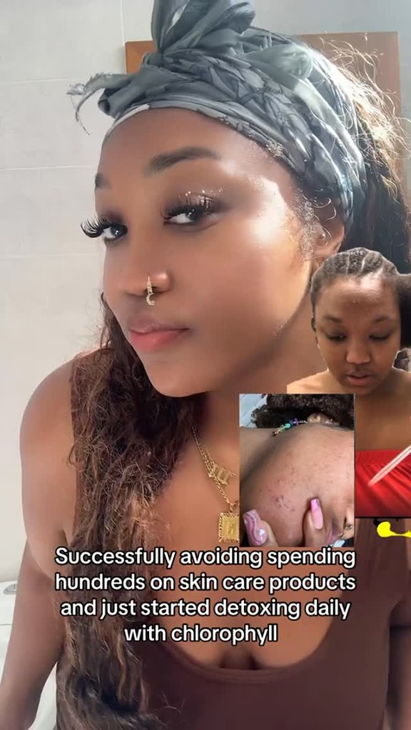 Ever since I started taking the Body Magic Chlorophyll Capsules by Her Fantasy Box , my skin has been thiving glowing and clearer than it’s ever been ! 🌿✨

No more random breakouts, just smooth, hydrated, and clear skin from the inside out 😍.

I literally got asked the other day if i ever have breakouts because my skin is always so nice 🙂‍↔️ it’s literally just me taking CHLOROPHYLL!

It’s a gentle detox that keeps my body balanced, odor-free, and my gut happy 🙌🏽

My other self-care lineup from her fantasy box that hits every time 👇🏽
🫧 Yummy Soap + Refresh Soap
💦 Body Splash Oil (for that glow + scent)
🌸 Boric Acid Foam Soap

You won’t regret it — you’ll fall in LOVE 💖
#ClearSkinJourney #SelfCare #detox #guthealth #naturalglowingskin