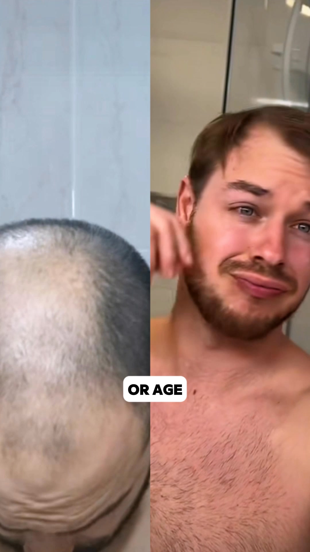 Restore your hair! 💆♂️