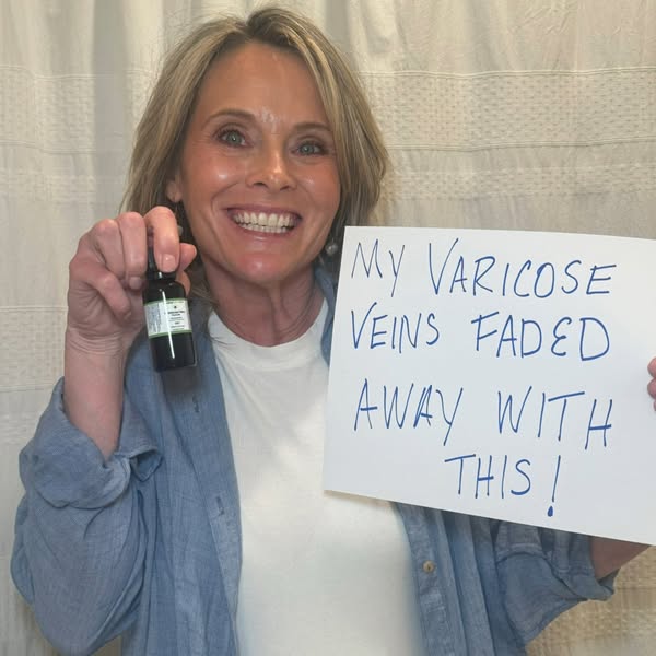 The Natural Choice For Varicose Veins