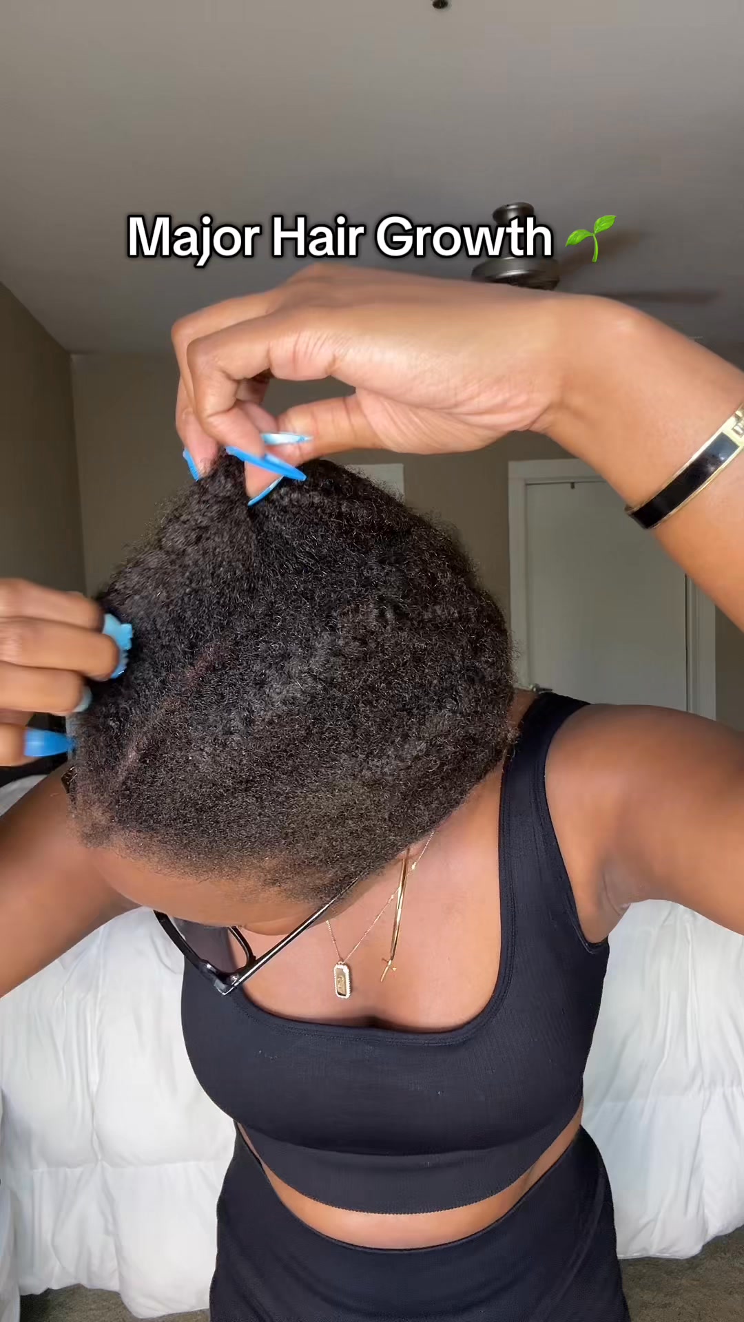 Vitamins That Will Give You Thicker & Healthier Hair →