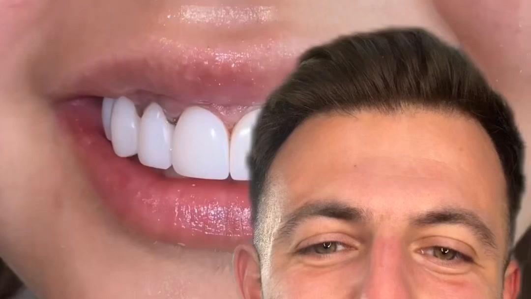 my top tip for getting rid of tea and coffee stains!!