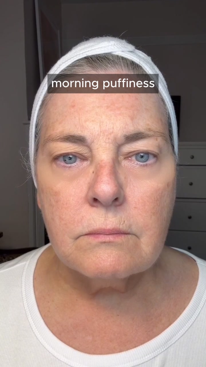 Say Goodbye to Puffy Eyes