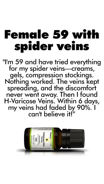 The Natural Choice For Varicose Veins
