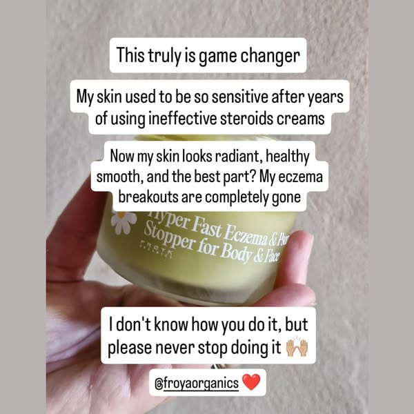 After Years of Eczema Pain, I Finally Found Hope 🌸