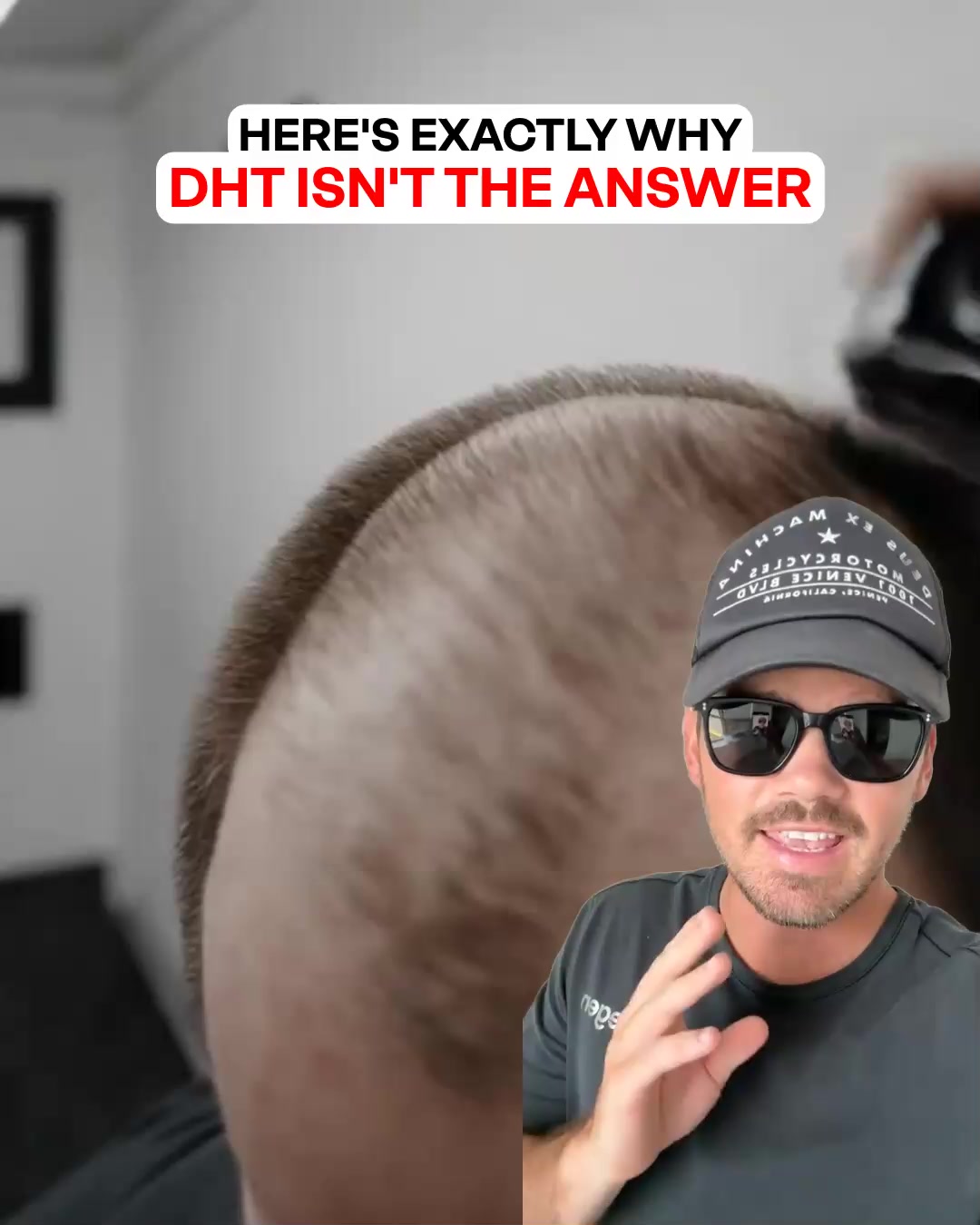 How To Stop & Reverse Hair Loss