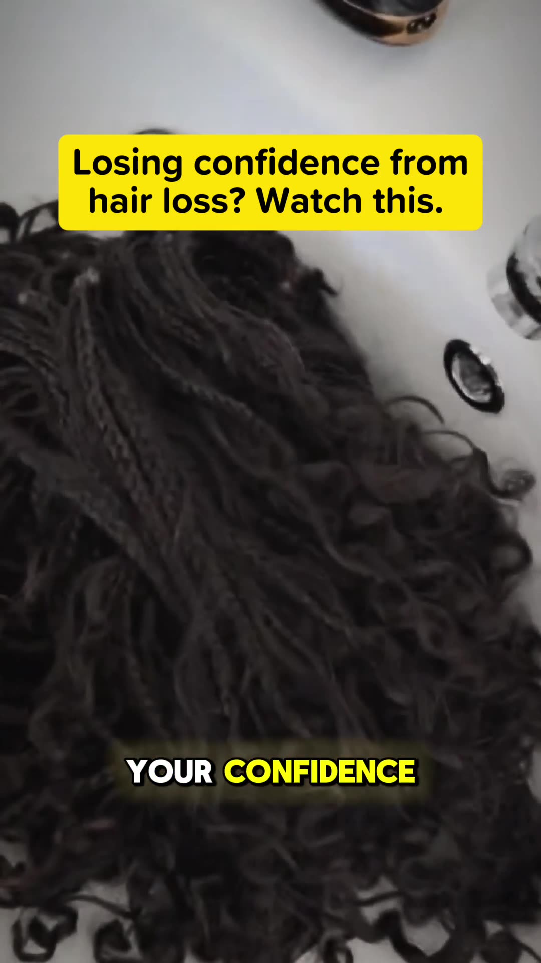 No Woman Should Feel She Has to Hide Her Hairline.