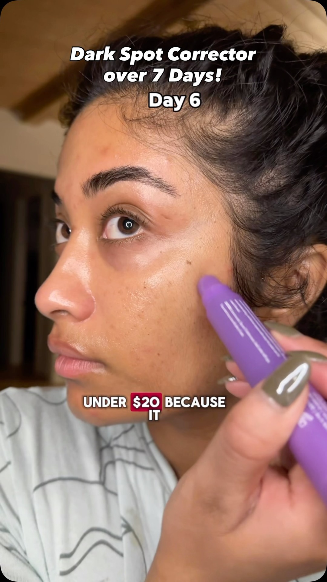 I’m pleasantly surprised at how well the @herocosmetics dark spot corrector worked for my dark spots!!! I use it morning and night over 7 days alongside my usual skincare routine It didn’t irritate my skin! For under $20 I think it’s worth checking out! #heropartner AD
#darkspots#hyperpigmentation#herocosmetics#browngirl#browngirlskincare