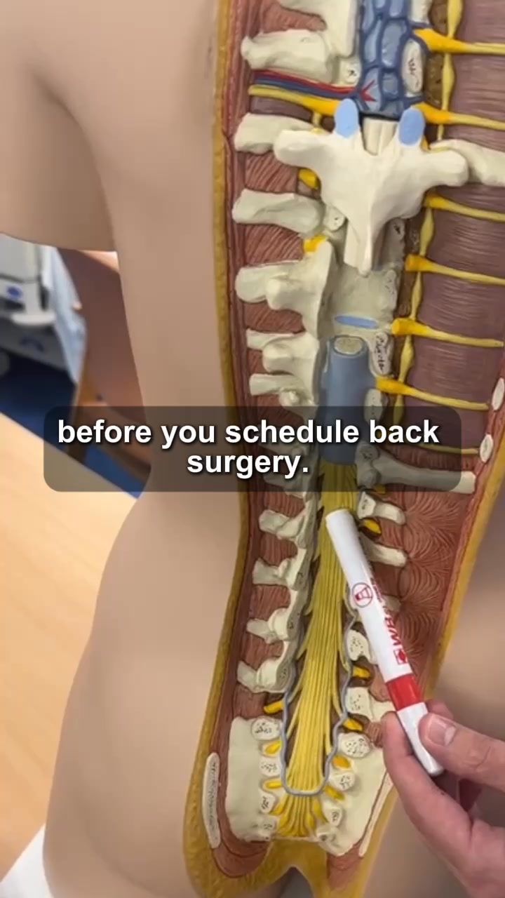 3 Ways To Get Back Pain Relief