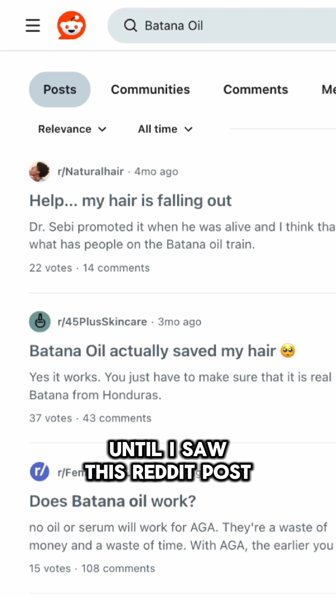 No Woman Should Feel She Has to Hide Her Hairline.