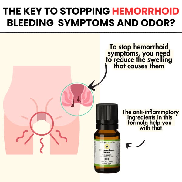 A Solution For Hemorrhoids That Works