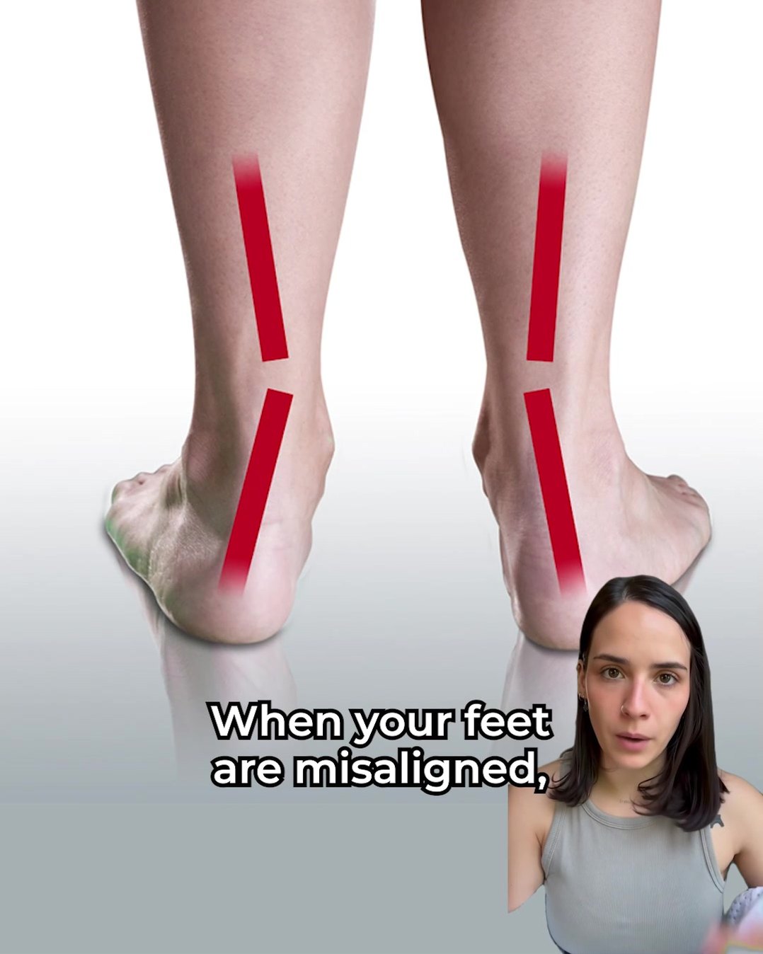 Stop Joint Pain with Insoles That Mold to You in 5 Minutes
