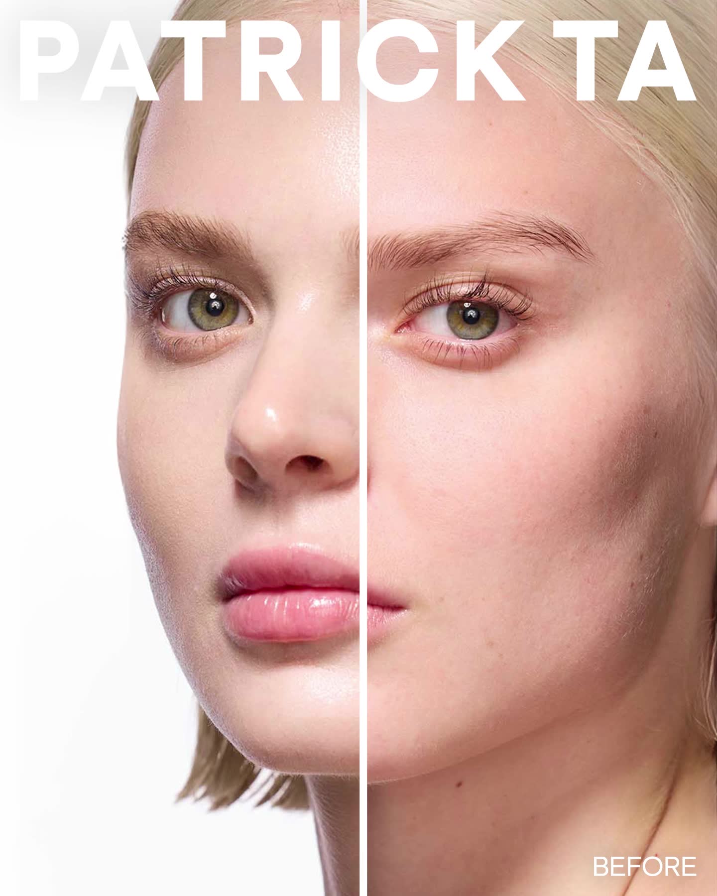 Major Skin: Before & After