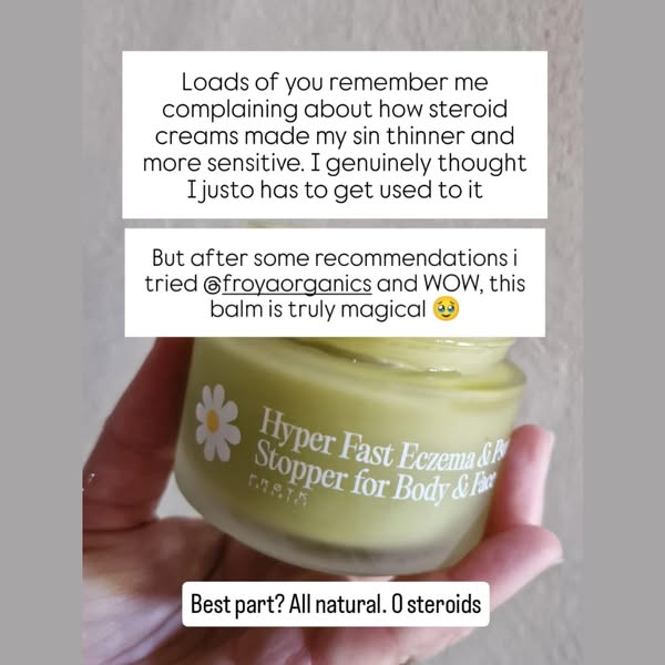 After Years of Eczema Pain, I Finally Found Hope 🌸