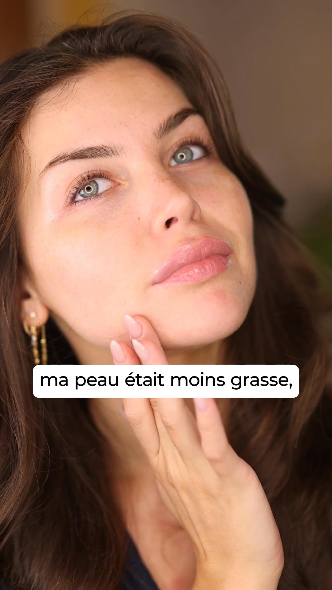 Nouveauté : Anti-Imperfections