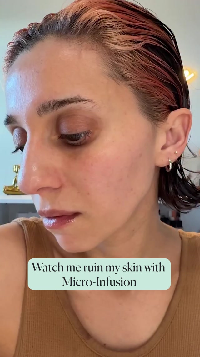 I Was Unsure About Micro-Infusion—Now I’m Hooked