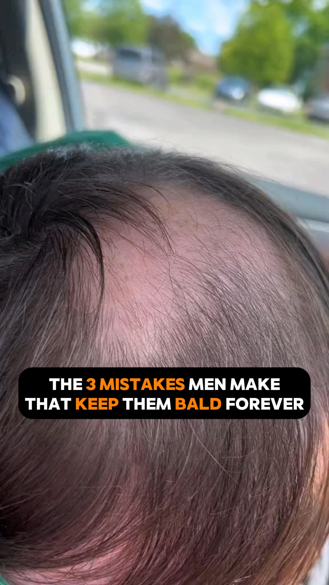 Restore your hair! 💆♂️