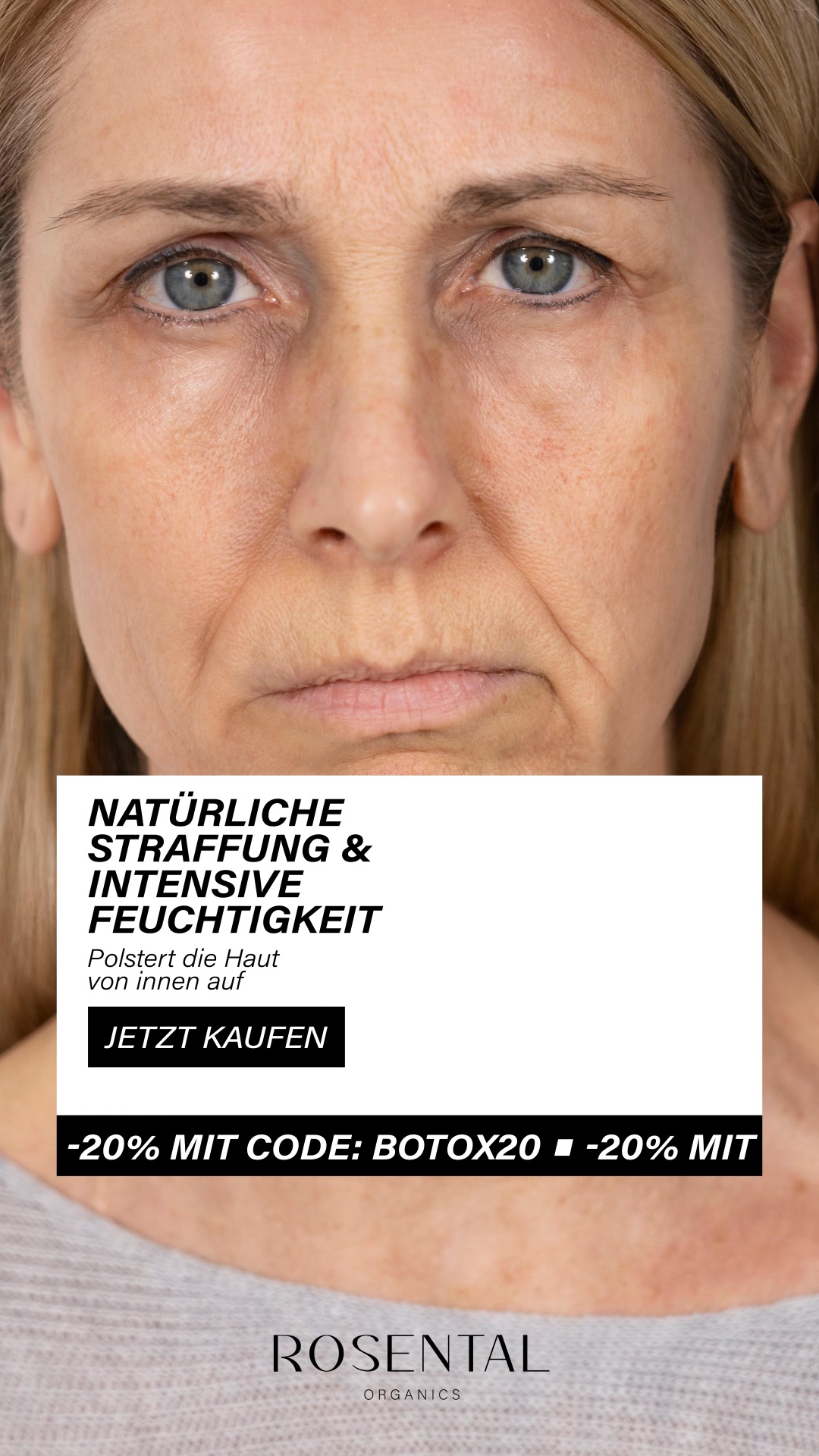 No Botox – just organics!  🌿✨
Das Botanical Lifting Set kombiniert die volle Kraft von Maske und Serum:

🌿 5% Spilanthol und 2% Szechuan Pfeffer glätten feine Linien und entspannen die Gesichtszüge.
🌿 Hyaluron sorgt für intensive Feuchtigkeit
🌿 Koffein strafft und belebt die Haut.

Sichtbar glattere und strahlendere Haut schon ab der ersten Anwendung. ✨✨