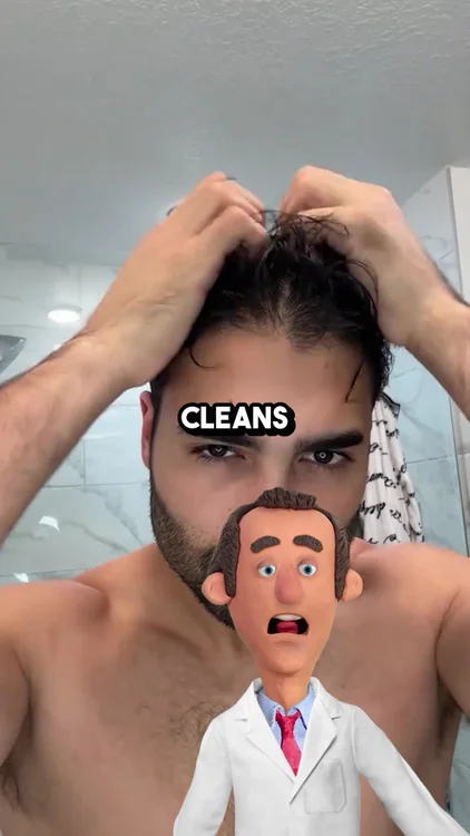 The First Baby Hairs Showed Up in Week 3