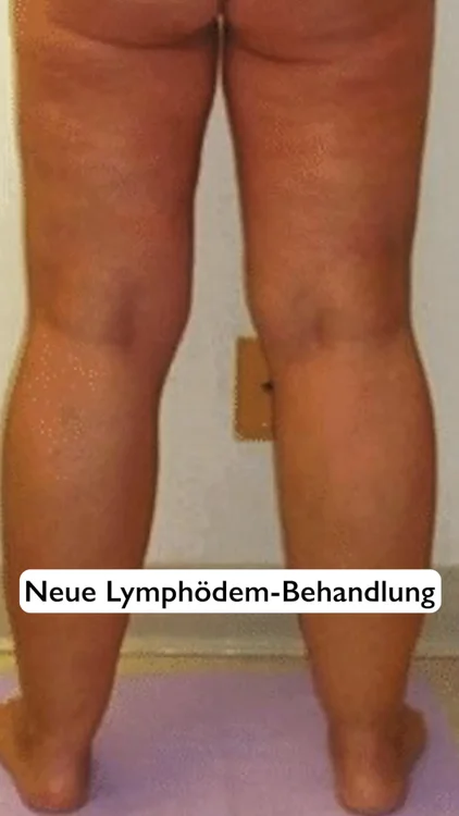 Bein- & Fußschmerzen waren gestern!